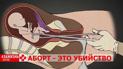 Влияние аборта на психику женщины